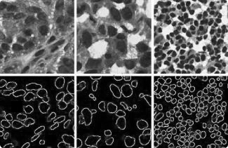 Deep Learning in detection of microscopic tissue features 2